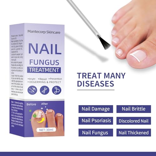 Toenail Fungus Treatment Extra Strength 30ml J26935